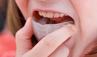 A child placing a mouthguard into their mouth.