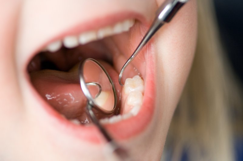 A closeup of a child’s mouth during a dental checkup